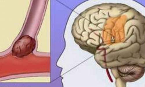 Nguy kịch vì tự ý dùng thuốc 1