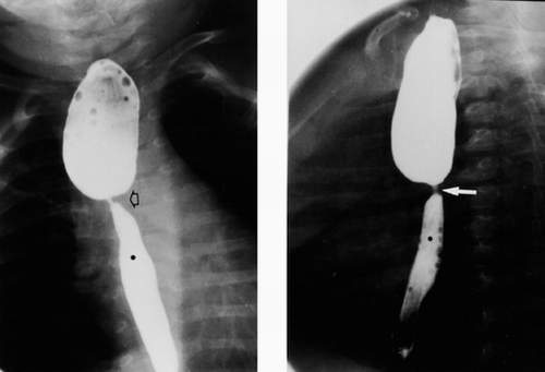 Các dị tật đường tiêu hóa 1