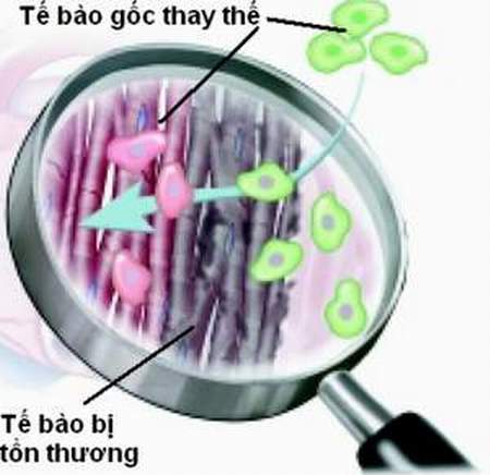 Ứng dụng tế bào gốc trong điều trị 2