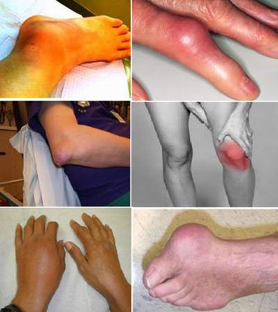 Cần phát hiện bất thường trong khi dùng thuốc 1