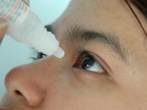 Có nên dùng thuốc chứa corticoid nhỏ mắt? 1