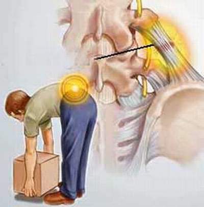 Hạn chế bệnh đau lưng - Cách gì? 1