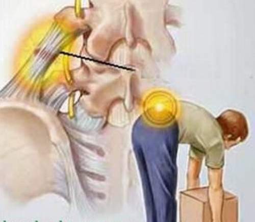 Nguyên nhân và biện pháp phòng tránh 1