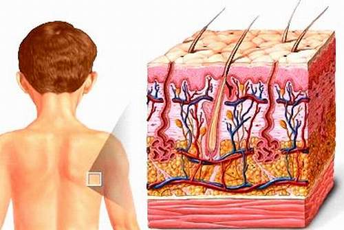 Viêm da atopy là bệnh gì?  1