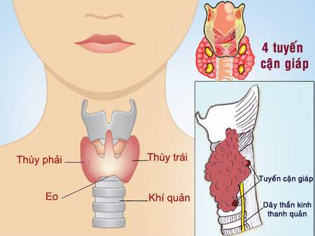 Suy tuyến giáp ở người già 1