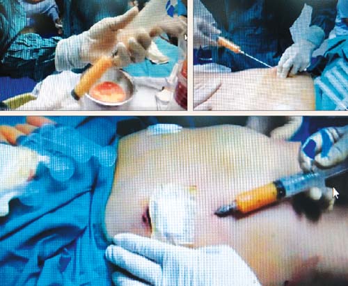 Cảnh báo về hiểm họa của các thủ thuật thẩm mỹ 1 Cảnh báo về hiểm họa của các thủ thuật thẩm mỹ 1