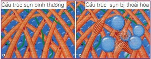 Để khô khớp không làm phiền 2