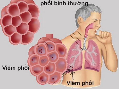 Bạch hoa xà thiệt thảo có tác dụng chữa các bệnh viêm đường hô hấp.