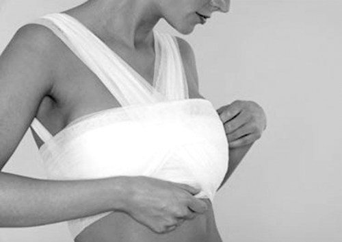 Khi nào cần phẫu thuật phì đại tuyến vú?- Ảnh 2. Một trường hợp phì đại tuyến vú hiếm gặp