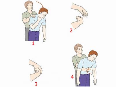 Người đàn ông 56 tuổi hoảng loạn vì ong vò vẽ sống trong tai- Ảnh 2.