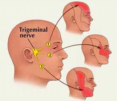 Thuốc trị đau dây thần kinh sinh ba