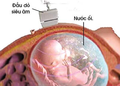 Nước ối và sự phát triển của thai nhi
