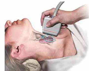 Bệnh Basedow dùng thuốc gì?