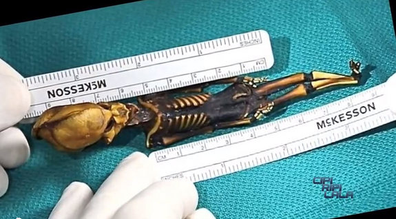 Bộ xương giống người ngoài hành tinh tiết lộ nhiều bí ẩn y học