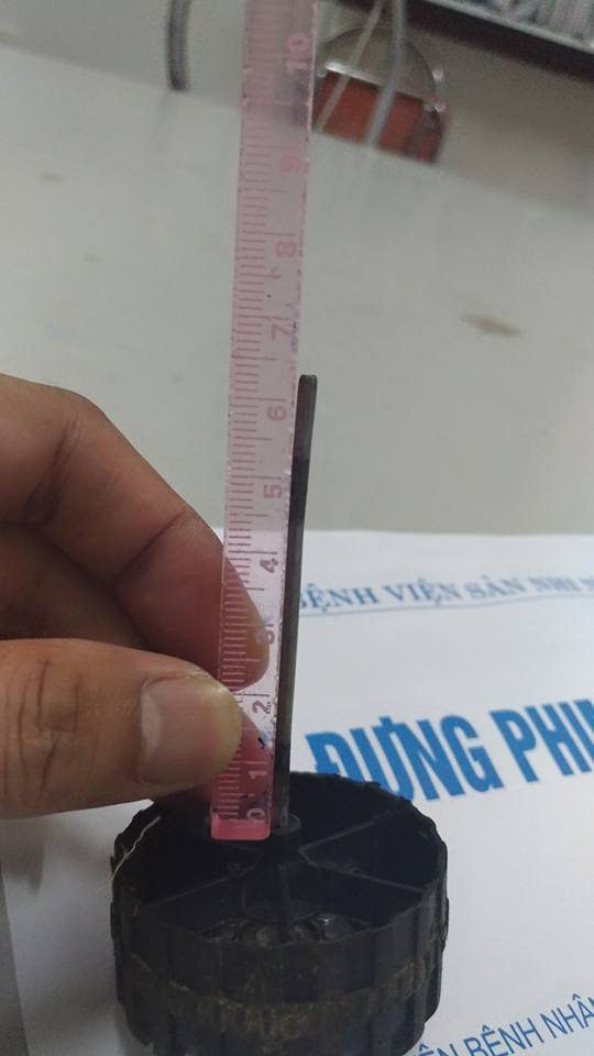 Đinh bánh xe bằng sắt dài hơn 6cm sau khi được lấy ra ở vùng má cháu bé