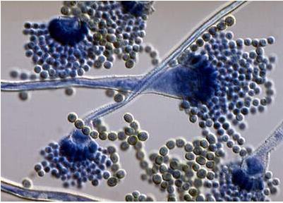 Nấm mốc Aspergillus flavus có trong thực phẩm dễ gây ung thư nam-moc-trong-thuc-pham-gay-ung-thu