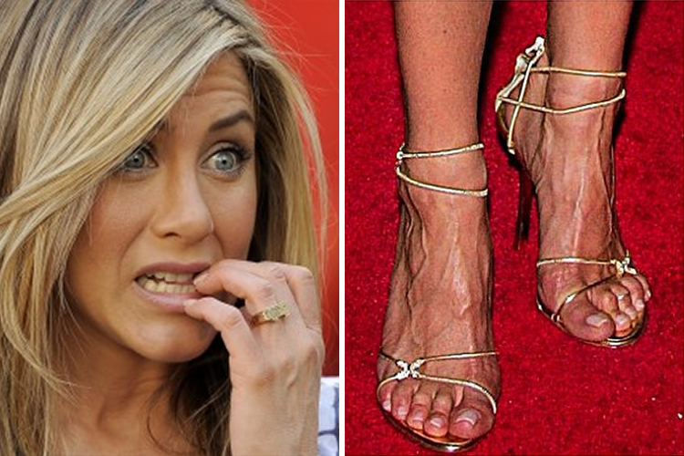 ban-chan-xau-xi-Jennifer-Aniston