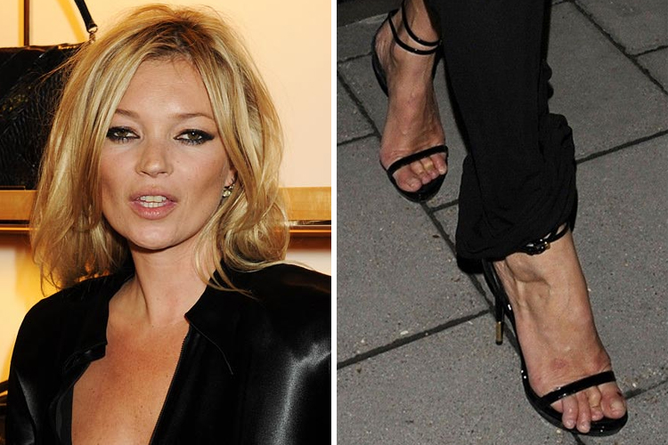 ban-chan-xau-xi-Kate-Moss