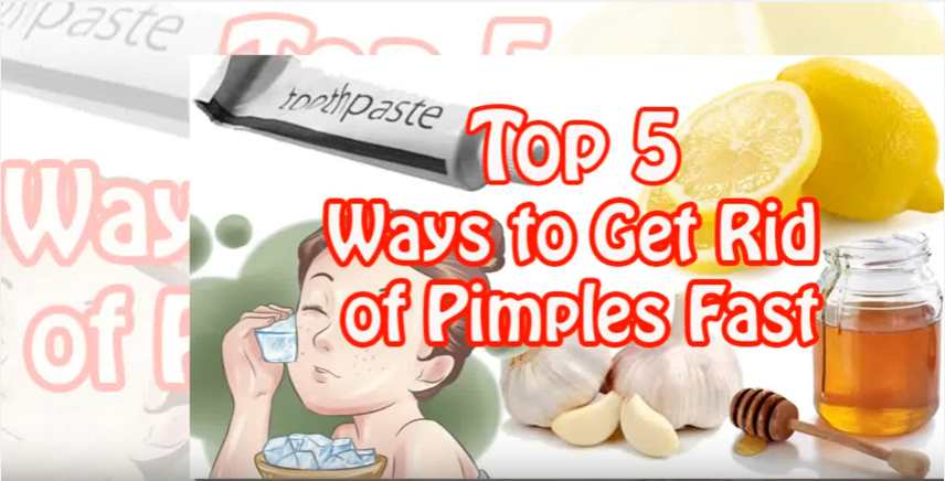 Mụn bọc trên mặt dễ biến chứng nếu tự ý nặn mụn- Ảnh 2. 5 cách loại bỏ nhanh mụn bọc dễ làm