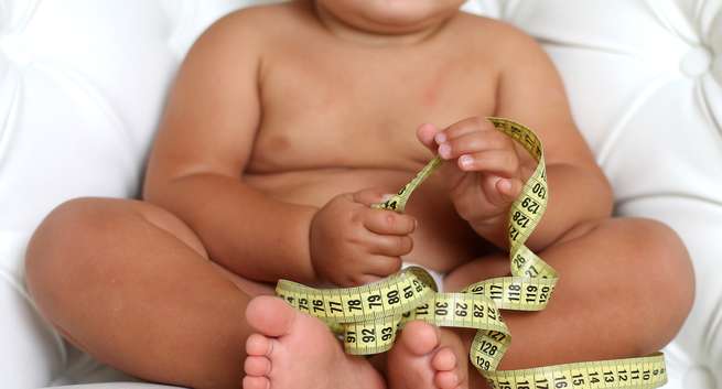 Béo phì lúc nhỏ tăng nguy cơ mắc bệnh ở hông