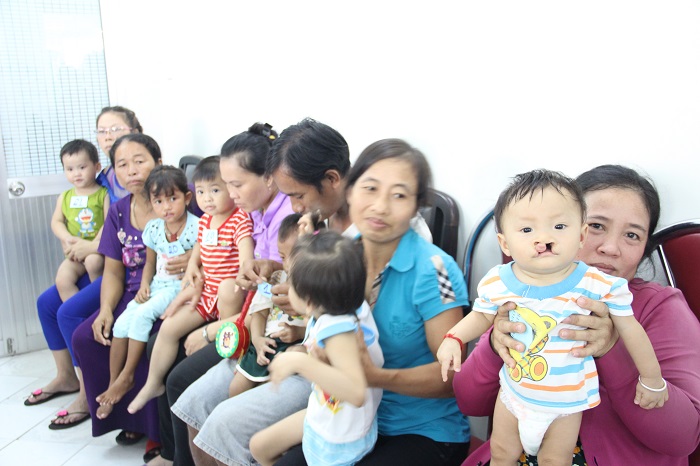phẫu thuật hàm mặt cho các bé