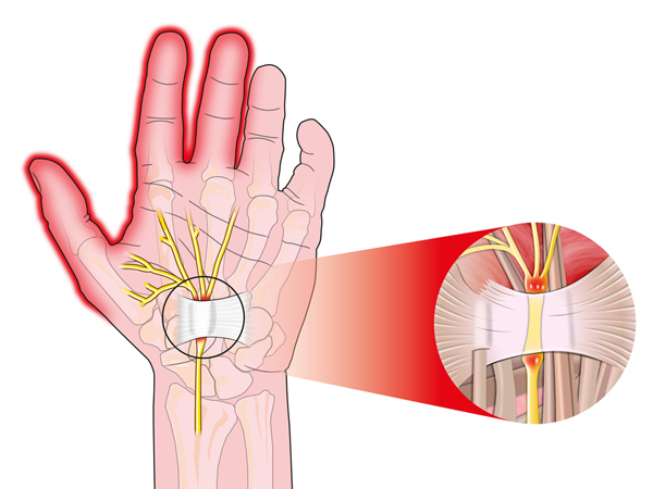 Ảnh hưởng đến hệ thần kinh