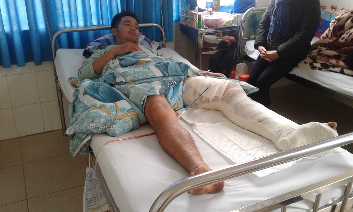 BVĐK Lâm Đồng nối thành công động mạch đùi