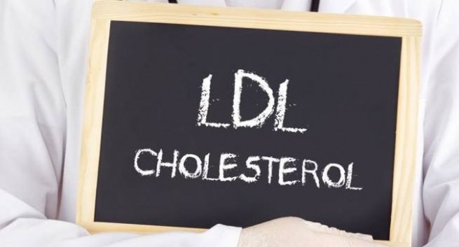 Vì sao nên kiểm tra cholesterol thường xuyên sau cơn đau tim