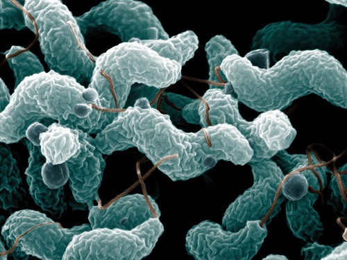 Vi khuẩn gây viêm ruột Campylobacter Jejuni