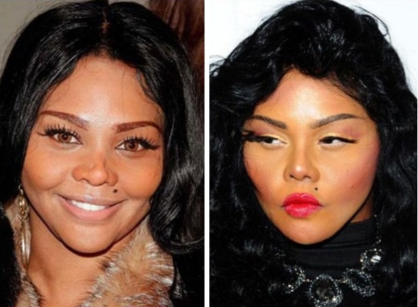 Lil' Kim và gương mặt Barbie sau phẫu thuật căng da