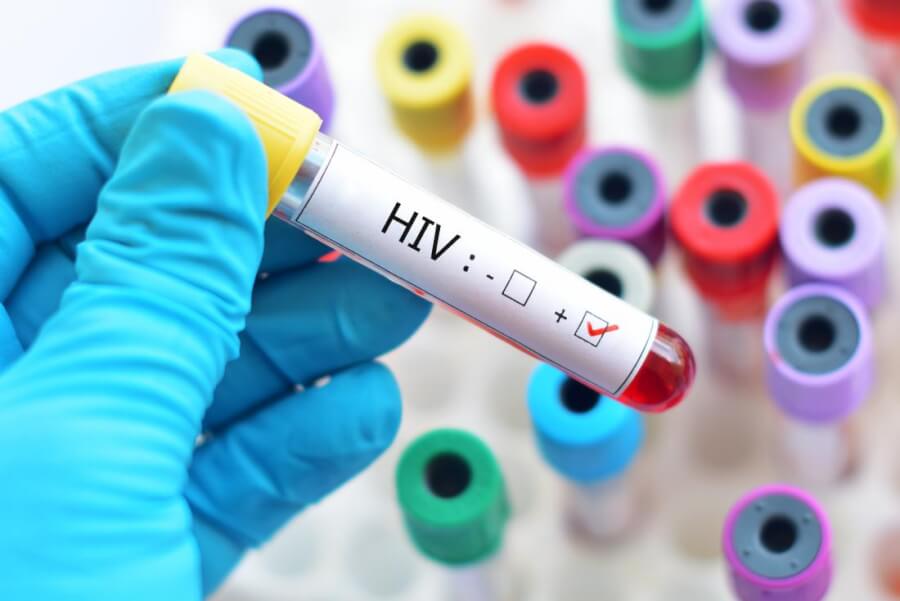 Kỳ diệu Thế giới thêm 1 người hết hẳn virus HIV