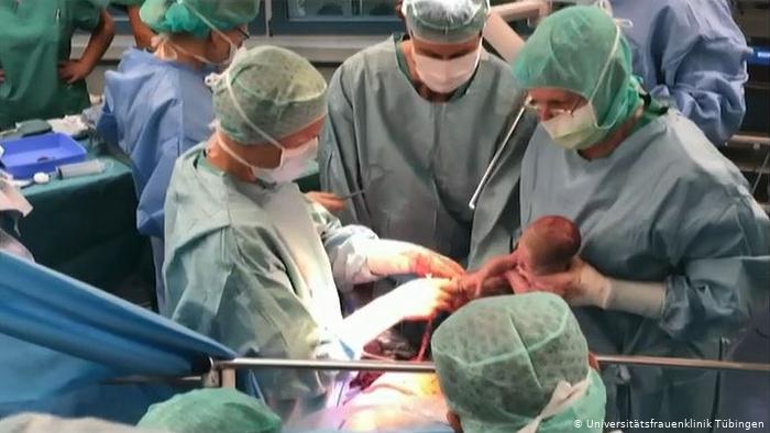 Ca đỡ đẻ cho em bé sinh ra từ mẹ ghép tử cung tại Bệnh viện Đại học Phụ nữ ở Tubingen, Đức