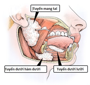 U tuyến nước bọt mang tai có đáng lo?