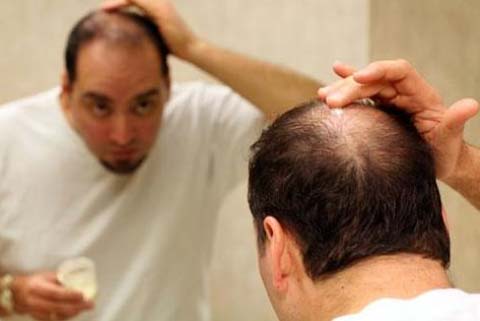 Rụng tóc nhiều ở nữ tuổi 17 có sao khôngsai lầm đến từ cách buộc tóc