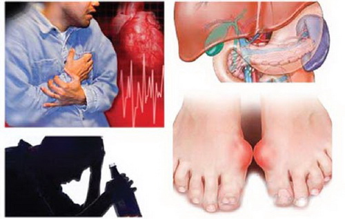 Lạm dụng rượu gây tác hại cho nhiều cơ quan trong cơ thể.