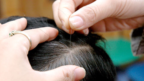 Trị tóc bạc sớm bằng cách bấm huyệt - Spa chăm sóc tóc & da Thảo Dược CỎ  THƠM