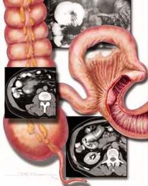 Hình ảnh khối u qua chẩn đoán CT và MRI scan.