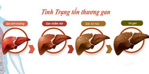 tình trạng tổn thương gan