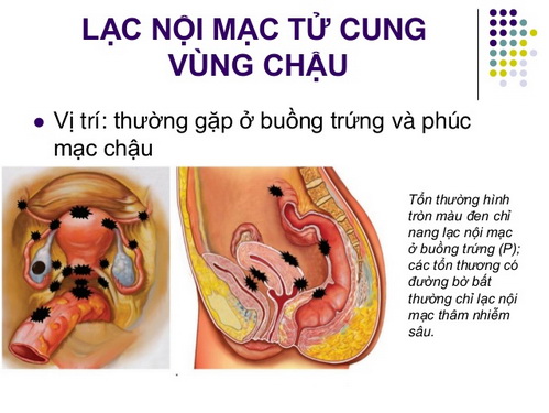 3. Các bệnh lý liên quan