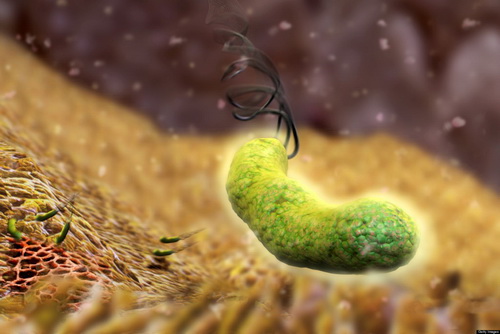 Vi khuẩn H.pylori trong dạ dày.