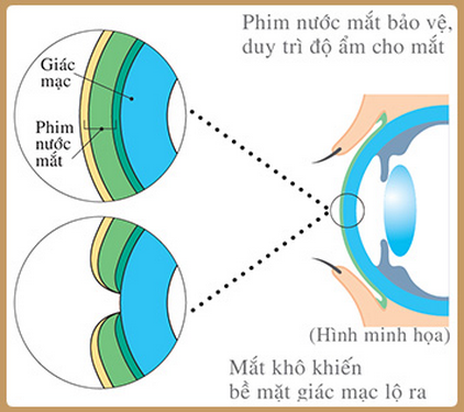 Nước mắt khi che phủ trên bề mặt nhãn cầu có vi cấu trúc như một film mỏng gồm 3 lớp.