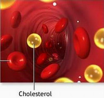 Tăng cholesterol trong máu là một trong những nguy cơ hàng đầu của các bệnh tim mạch.