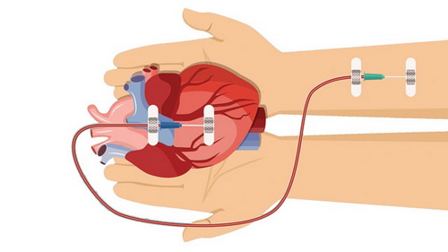 Để cải thiện tỷ lệ hiến tạng ở Ấn Độ, trước hết phải thay đổi nhận thức của người dân.