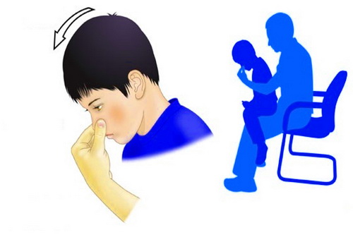Tư thế và cách để cầm chảy máu mũi cho trẻ.