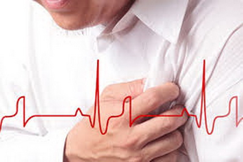 Cần phân biệt cơn đau tim với đột quỵ.