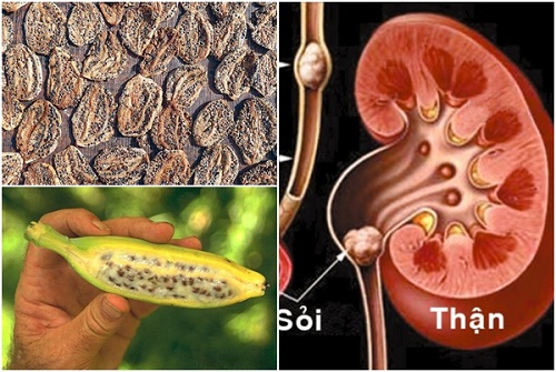 Chuối hột sấy khô chữa viêm loét dạ dày, sỏi thận.