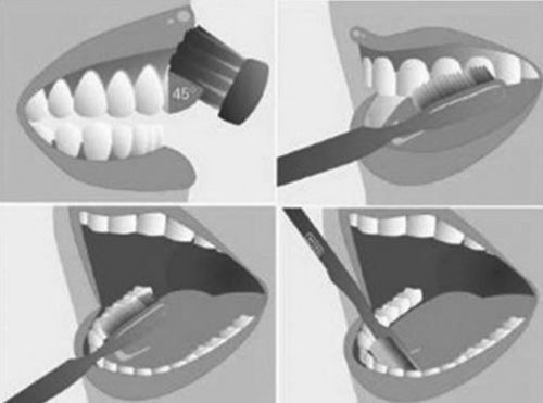 Chải răng đúng cách để phòng bệnh nha chu.