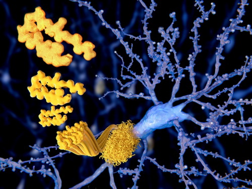 Các chất ức chế trong não gây bệnh Alzheimer.