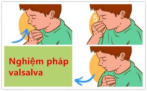 Nghiệm pháp Valsalva giúp nhịp tim dần dần hạ xuống.