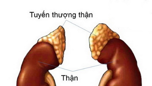 Suy tuyến thượng thận dẫn đến rối loạn các quá trình chuyển hóa trong cơ thể.